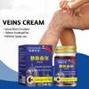 Varicose and Spider Veins Ease for Legs, Improve Blood Circulatio