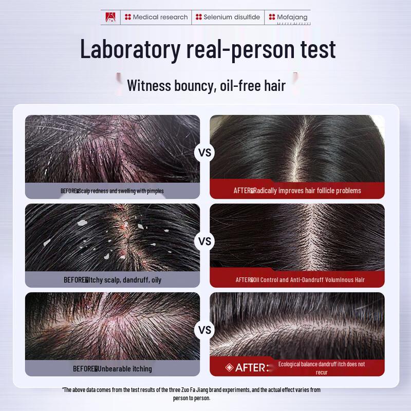 Three Magical Craftsmen Selenium Disulfide Anti-Dandruff Shampoo