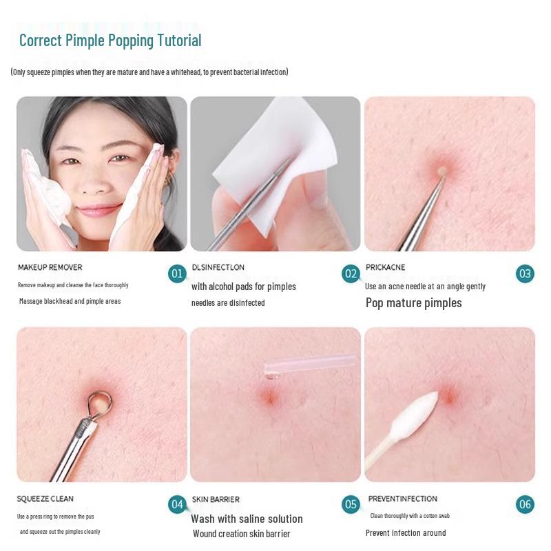 Ультратонкий набор для удаления черных точек: Пинцеты высокой точности, скребок для комедонов, бьюти-пик и инструменты-иглы от акне