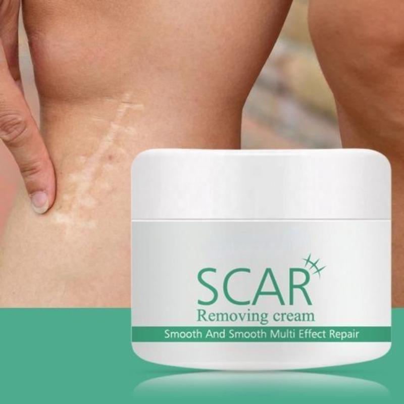 Кремы для удаления шрамов от прыщей и растяжек с натуральными экстрактами растений для нее