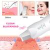 Blackhead Scraper Electric Pore Cleaner Acne Removal Exhaust Instrument Suction Wonder Ultrasonic Peeler