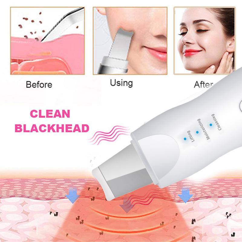 Blackhead Scraper Electric Pore Cleaner Acne Removal Exhaust Instrument Suction Wonder Ultrasonic Peeler