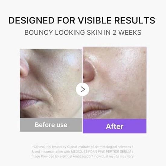 Medikube Booster Pro Mini Plus Основной блок (розовый) Устройство для ухода за кожей и красоты