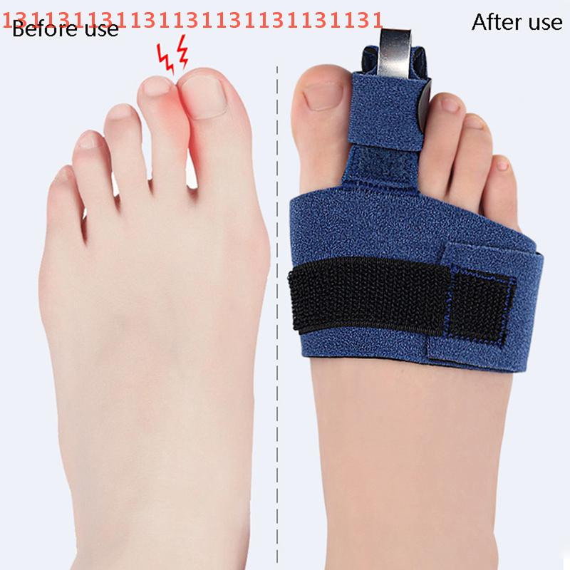 1Pcs Toe Corrector Toe Fracture Fixator Orthotics Foot Bone Thumb Adjuster Correction Soft Pedicure Socks Bunion Straightener