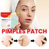 200Pcs Acne Pimple Patch Sticker Waterproof Acne Treatment Pimple Remover Tool Blemish Spot Facial Mask Skincare Hidden Pimple