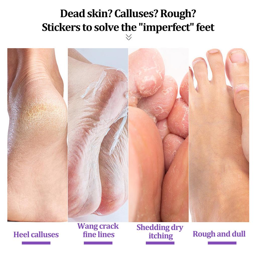 EELHOE Ginger Foot Mask Moisturizing Whitening Exfoliating Foot Mask Callus Remover for Feet Pedicure Spa Socks Natural Plant Skin Care