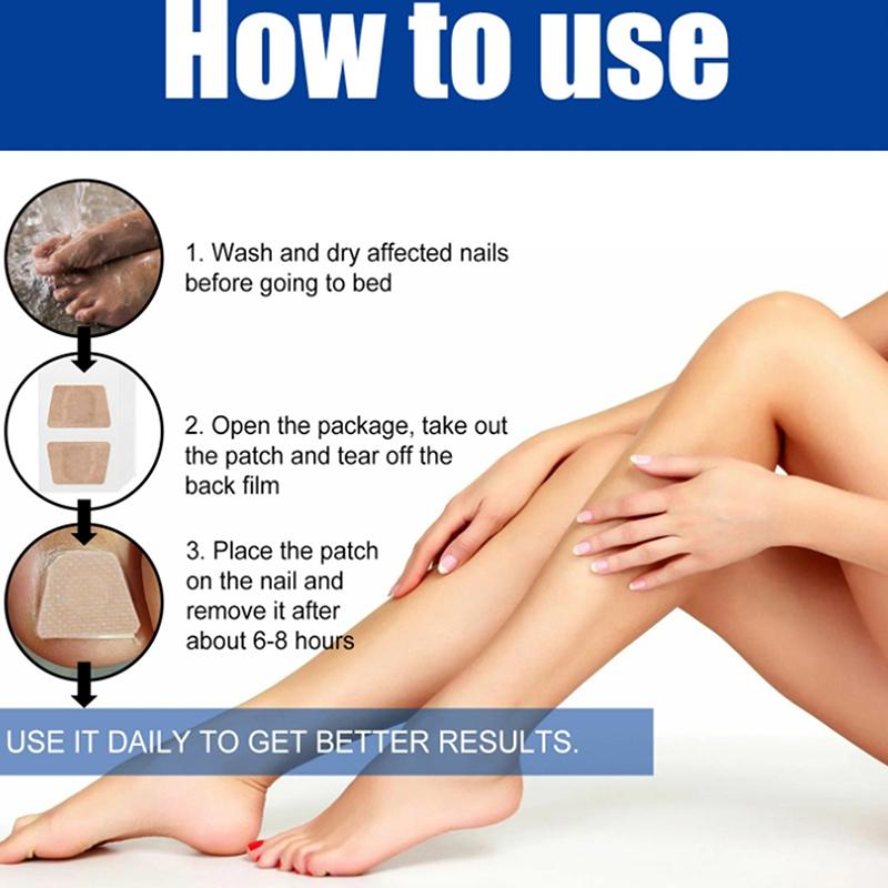 60Pcs Toenail Fungus Treatment Patches Sticky Nail Ingrown Care Correction Stickers for Paronychia Nail Repair