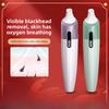Visual Blackhead Instrument, Pore Cleaning Processor, Facial Cleanser, Facial Cleanser with Camera, Vacuum Blackhead Suction, Charging, New Product.