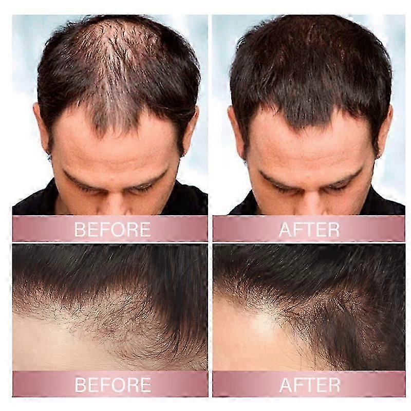 3x EELHOE ProRevita Rice Nutn Spray Hair Darken & Enhancer Coffee Extract 50mlZZ43