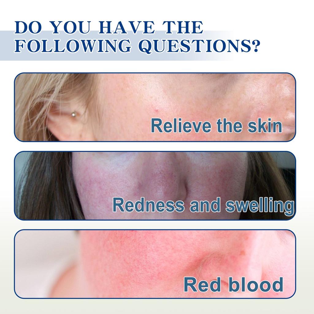 Паста для лица от розацеа, коллагеновая паста, покраснение, сухая, чувствительная, зуд, кожа, увлажняющая, успокаивающая.