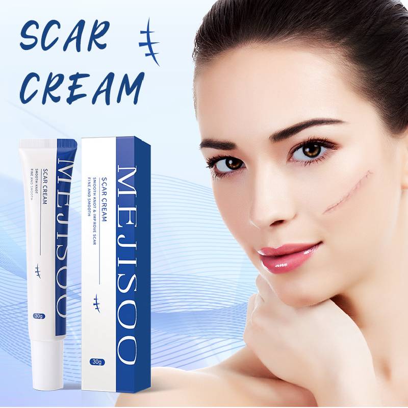 Scar Removing Cream Fade Acne Scars Color Moisturizing Fades Scars Gel Skin Care Body Cream