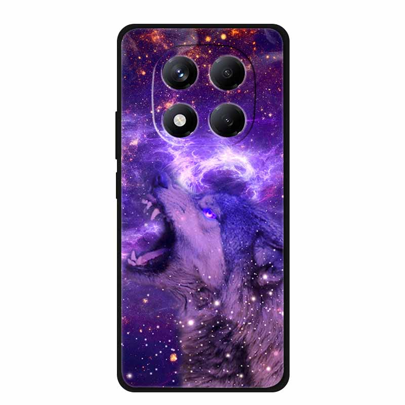 For Xiaomi Redmi Note 15 Pro / Note 15 Pro+ 5G Case Global Version 25060RABDG 2510ERA8BG Luxury Soft Silicone Back Cover Cases