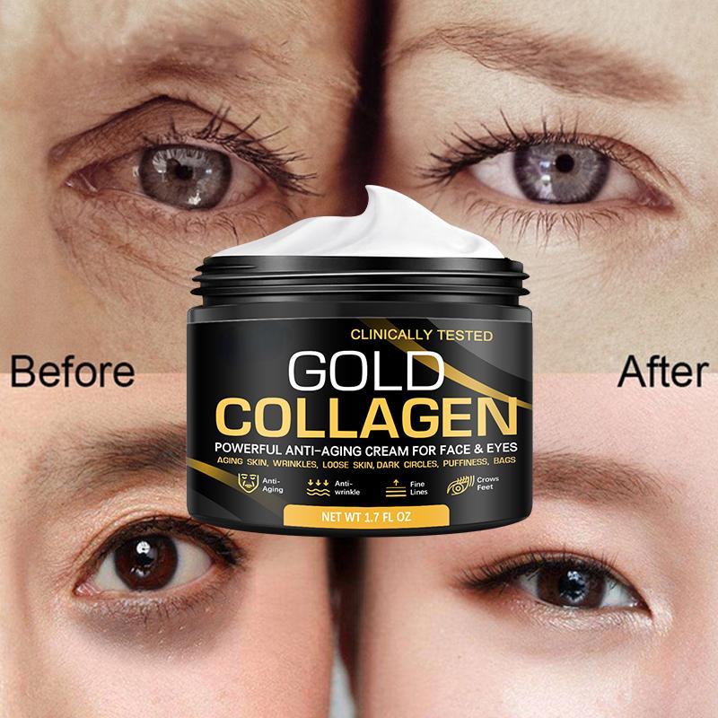 Крем для лица Крем с витамином С Удаление темных пятен Отбеливание Уход за лицом Увлажняющий антивозрастной укрепляющий уход за кожей Косметика