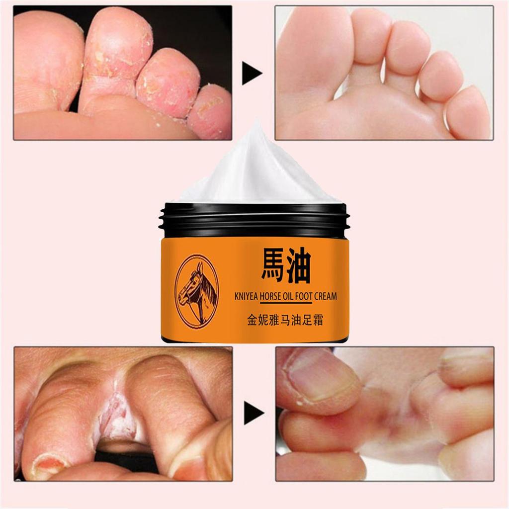 Крем для ног Крем для заживления трещин на пятках Устранение омертвевшей кожи Уход за руками и ногами Увлажняющий крем