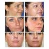 30 мл крем для удаления темных пятен от веснушек, витамин C 20, портативный C20, отбеливающий крем от веснушек для женщин