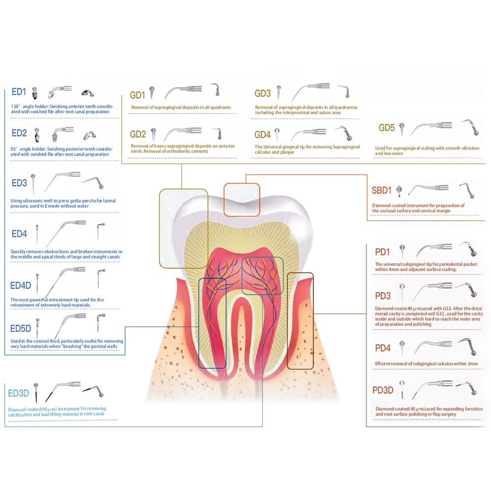 5 шт. насадок для стоматологического скалера, подходят для наконечника ультразвукового скалера EMS/WOODPECKER/SATELEC/DTE/NSK, стоматологические ультразвуковые насадки для скалинга