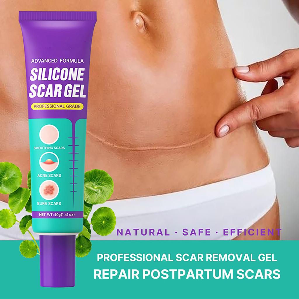 Гель от шрамов Крем от шрамов Легкая линия Мягкая Легкая линия 40 г