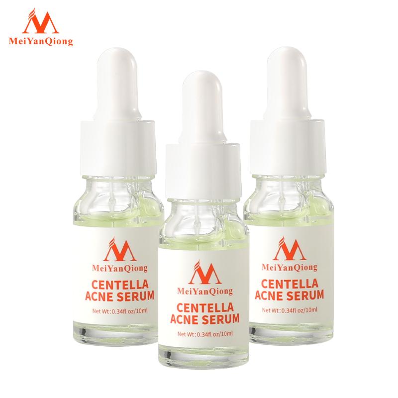 Сыворотка на травах против акне, предотвращает появление морщин. Уменьшает поры. Контролирует жирность кожи лица