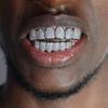 Removable Design Hiphop Teeth Grillz Top & Bottom Set Charm Teeth Grillz  Dental Crown
