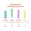 Foxtale ABC of Acne Control Trio Набор для ухода за кожей | Гель для точечного лечения акне 15 мл + Очищающее средство для умывания 100 мл + Увлажняющий крем с керамидами 50 мл