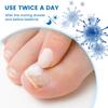 Plaster New Bright Nail Plaster Relieves Onychomycosis And Nail Care