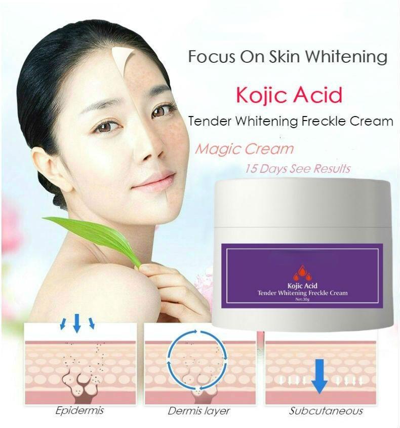 Отбеливающий крем для лица с койевой кислотой, корректор темных пятен от мелазмы и прыщей