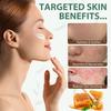 Beef Tallow Honey Balm - Organic Grass Fed Tallow Face Cream - Deeply Nourishing & Moisturizing Beef Tallow Skin Care for for Dry Skin, 120g