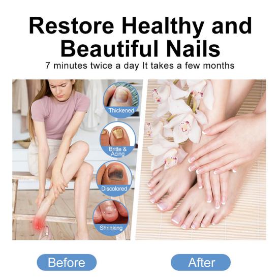 Portable Nail Therapy Lamp 910nm Infrared & 407nm Blue Light for Toenail Health Nail Fungus Treatment Device for Thick Damaged Nails