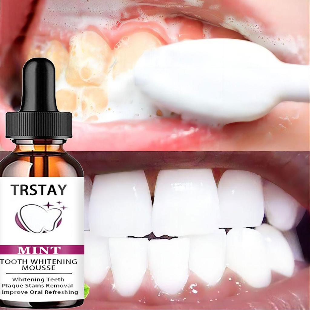5 мл/15 мл/30 мл/50 мл/TRSTAY отбеливание зубов средство для удаления налета Очищение зубов удаляет пятна отбеливание зубов гигиена полости рта зубная паста отбеливающий мусс