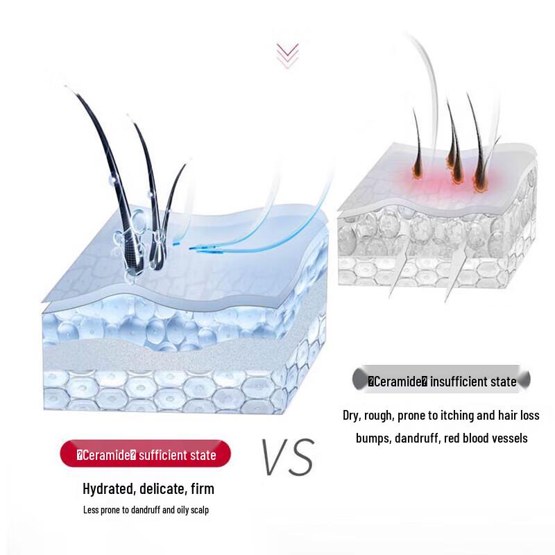 Sule PRO Scalp Refreshing Anti-Dandruff Shampoo