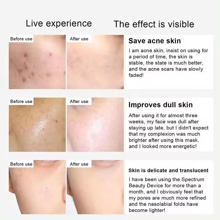 PDT 7-цветная светодиодная фототерапия для лица PDT светодиодная терапия светом Отбеливание и омоложение Косметологический аппарат Фотонное омоложение кожи и удаление акне