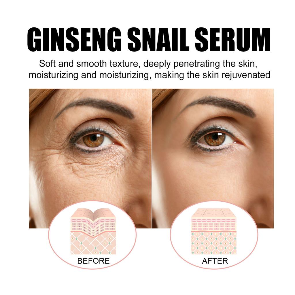 Ginseng Snail Extract Brighten Skin Tone Nourish Repair Dull Skin Fade Fine Lines Anti-Wrinkle Essence