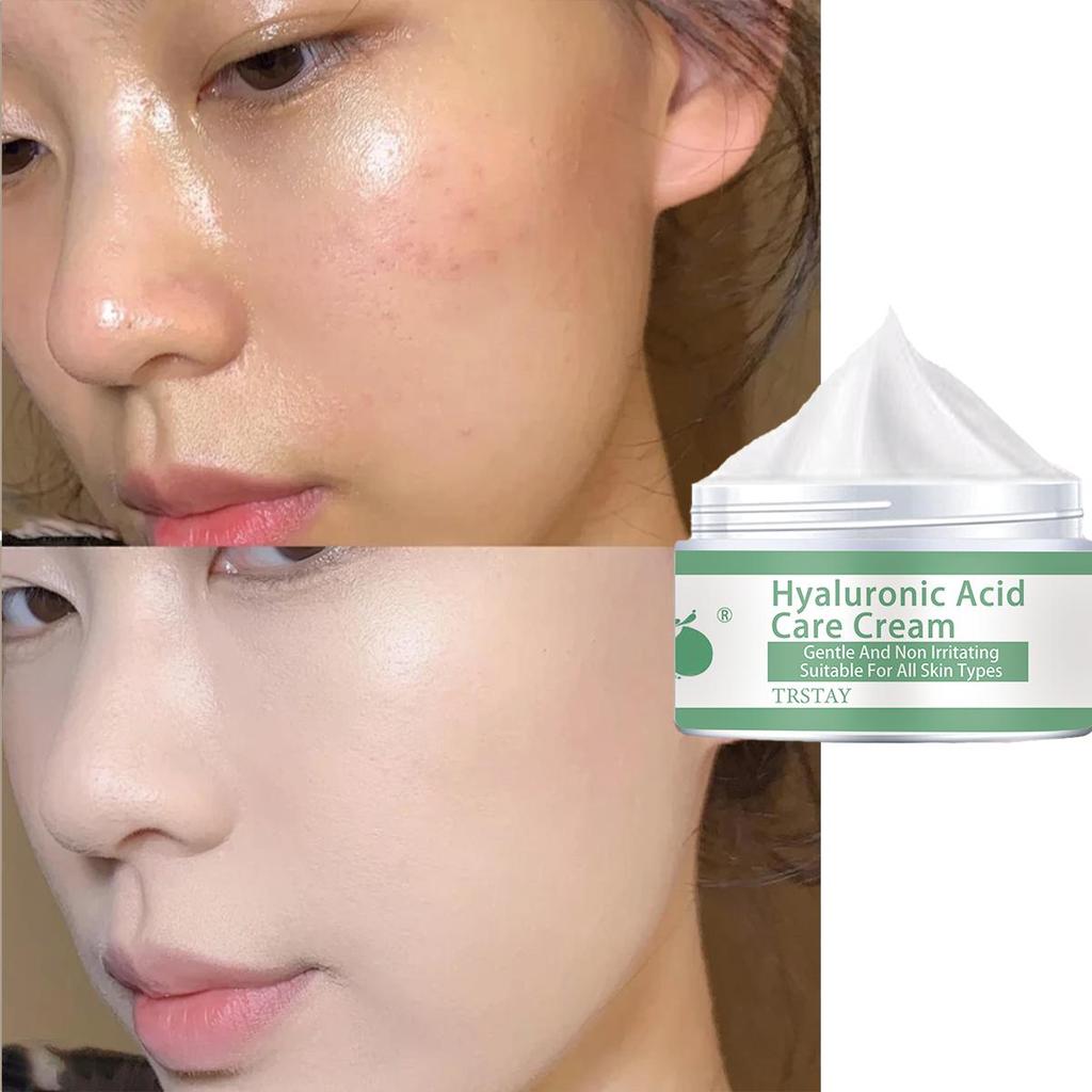 TRSTAY Витамин С для лица Крем для удаления пигментов и темных пятен Отбеливающий крем для лица Осветляющий уход за кожей Средства по уходу за кожей Красота Здоровье