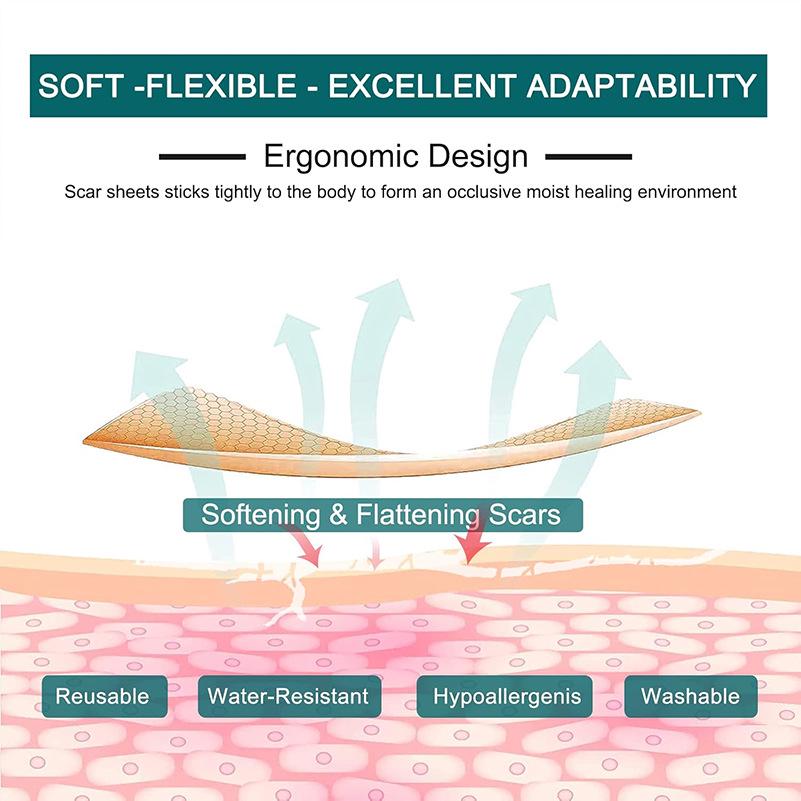 Трансграничные силиконовые пластыри для рубцов - Красота и уход за кожей - Рулон силиконового скотча