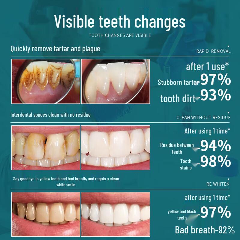 HIEUAILR Anti-Calculus Mouthwash