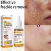 Remove Dark Spots Whitening Moisturizing Skin Care Anti Wrinkle Face Serum Turmeric Essential Oil Therapeutic Acne Shrink Pores