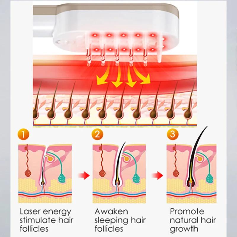 Щетка для фототерапии, расческа для кожи головы, беспроводной массажер для головы со светодиодным дисплеем, против выпадения волос, для снятия усталости, лазерная расческа для роста волос
