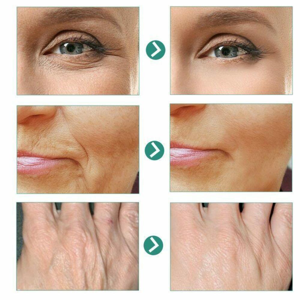 5 секунд для удаления морщин, мгновенный антивозрастной крем для лица, подтягивающий, укрепляющий кожу