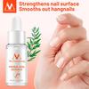 Nail Repair Nail Feet Care Essence Nail Foot Whitening Toe Nail Removal Gel