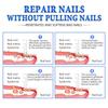 Repair Nail Fungus Treatments Essence Foot Care Serum Toe Nails Fungal Removal Gel Anti-Infection