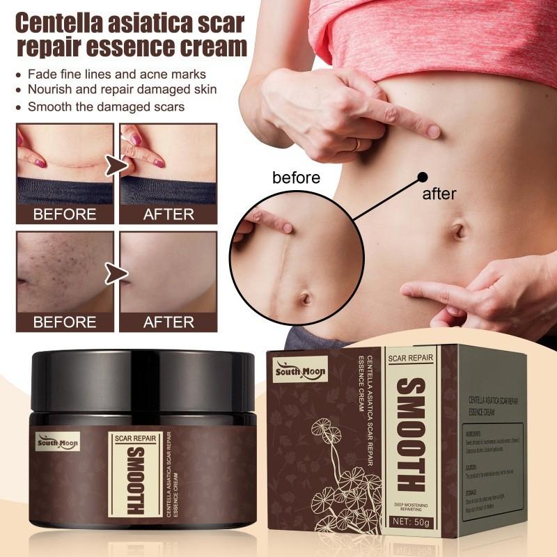 Крем для восстановления рубцов South Moon Centella Увлажняющая формула для подтягивания и разглаживания кожи для рубцов и пятен
