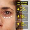 Сыворотка-гель для век с койевой кислотой и куркумой Vita Eye Gel Serum, заметно осветляет тусклые, темные круги под глазами, с витамином С и кофеином, антивозрастной крем для век от темных кругов