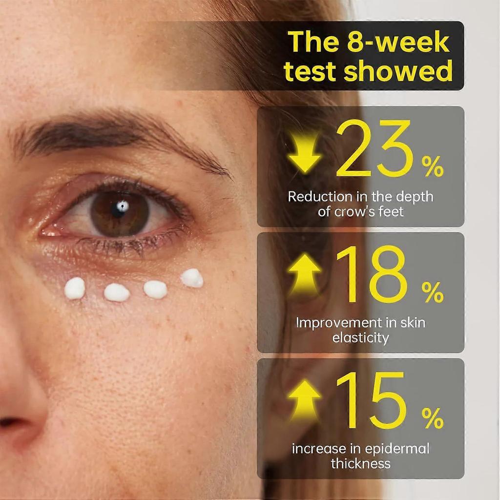 Сыворотка-гель для век с койевой кислотой и куркумой Vita Eye Gel Serum, заметно осветляет тусклые, темные круги под глазами, с витамином С и кофеином, антивозрастной крем для век от темных кругов