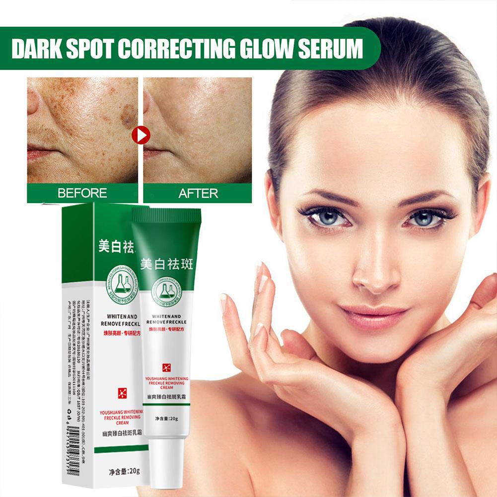 20 г отбеливающий крем от веснушек для удаления темных пятен на лице крем от мелазмы осветляет пигментацию лыжи P9L3
