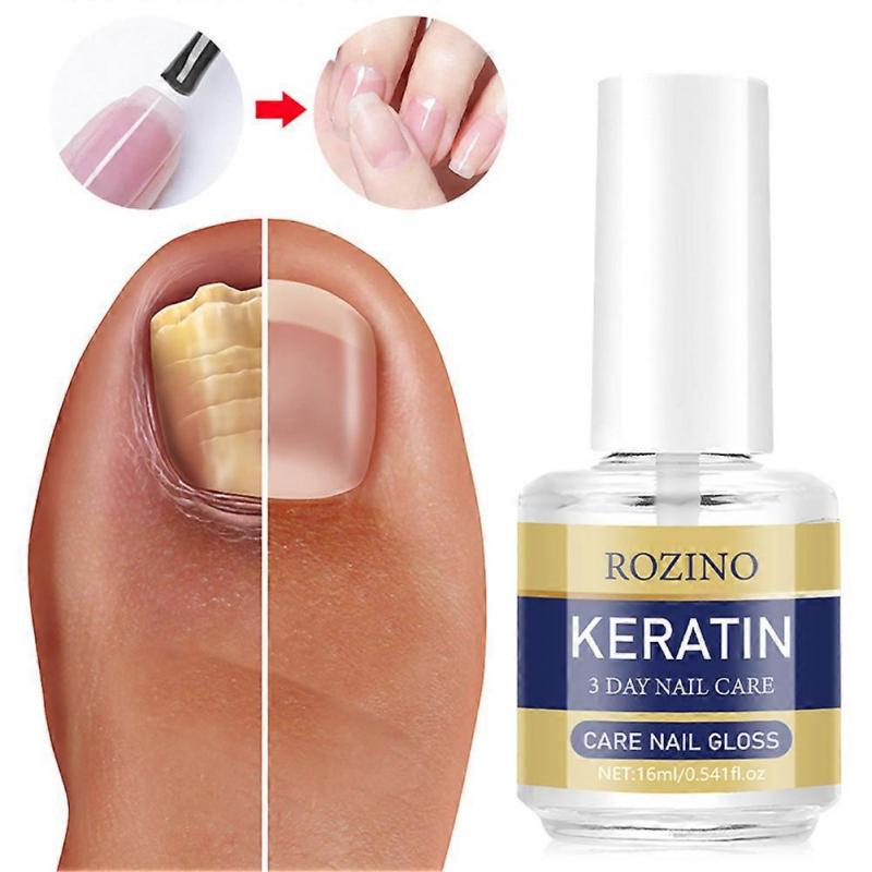 Nail 3 Day Growth Treatments Natural Nail Strengthener Fast Keratins Nail Hardener for Damage Nails