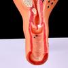 Pathological Uterus Ovary Anatomical Model Anatomy Cross Section Study Tool