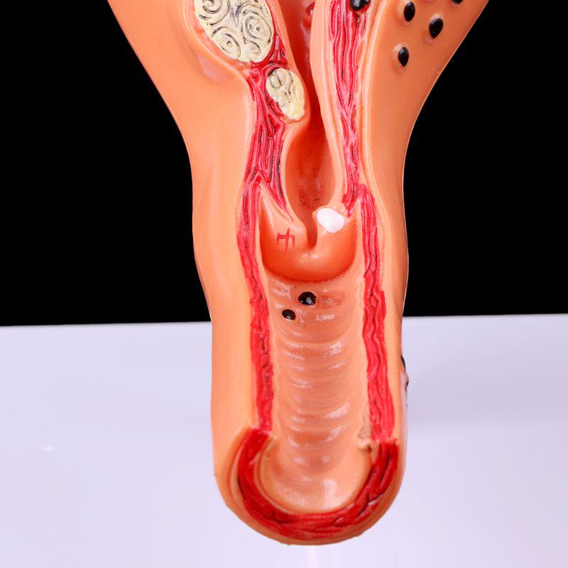Pathological Uterus Ovary Anatomical Model Anatomy Cross Section Study Tool