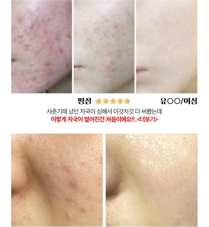 [CHAKAN] Centella Cica Real Pack Смываемая грязевая крем-маска 100 мл