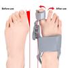 Hallux Valgus Corrector Toe Separator Enhances Comfort Durability All Day Support In Hallux Valgus Correction