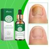 30ml Toenail , Fast-acting Nail , Nail Care For Toenails, Strengthening Of Brittle Nails, Nail Care,